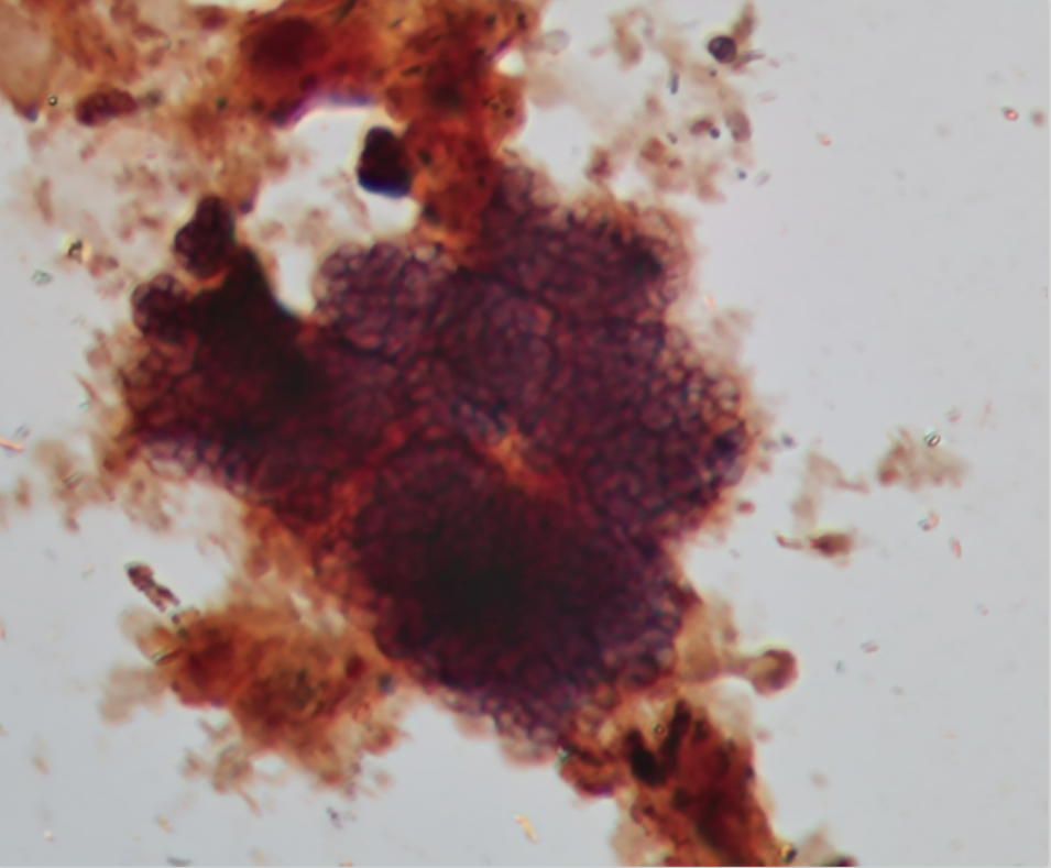 Gsob Insect Bug of the Month: Glycogen-Accumulating… | Treatment Plant Operator