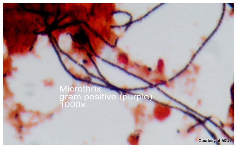 Microthrix Examples Bug of the Month: Control Strategies for… | Treatment Plant Operator