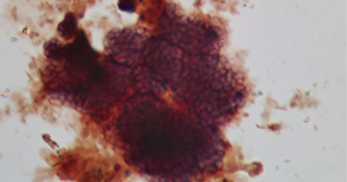 Bug of the Month: Glycogen-Accumulating… | Treatment Plant Operator