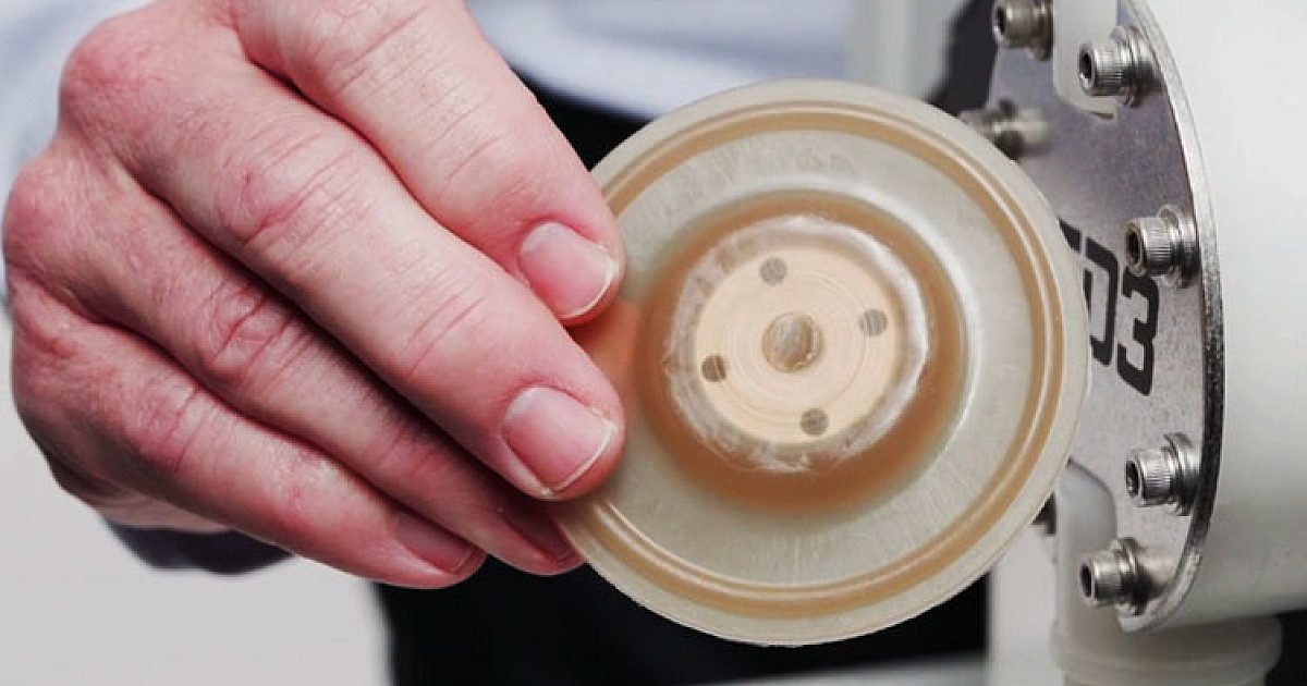 Blue-White’s Exclusive DiaFlex Diaphragms | Treatment Plant Operator