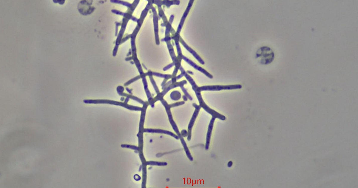 bug-actinomycetes-mycolata.png