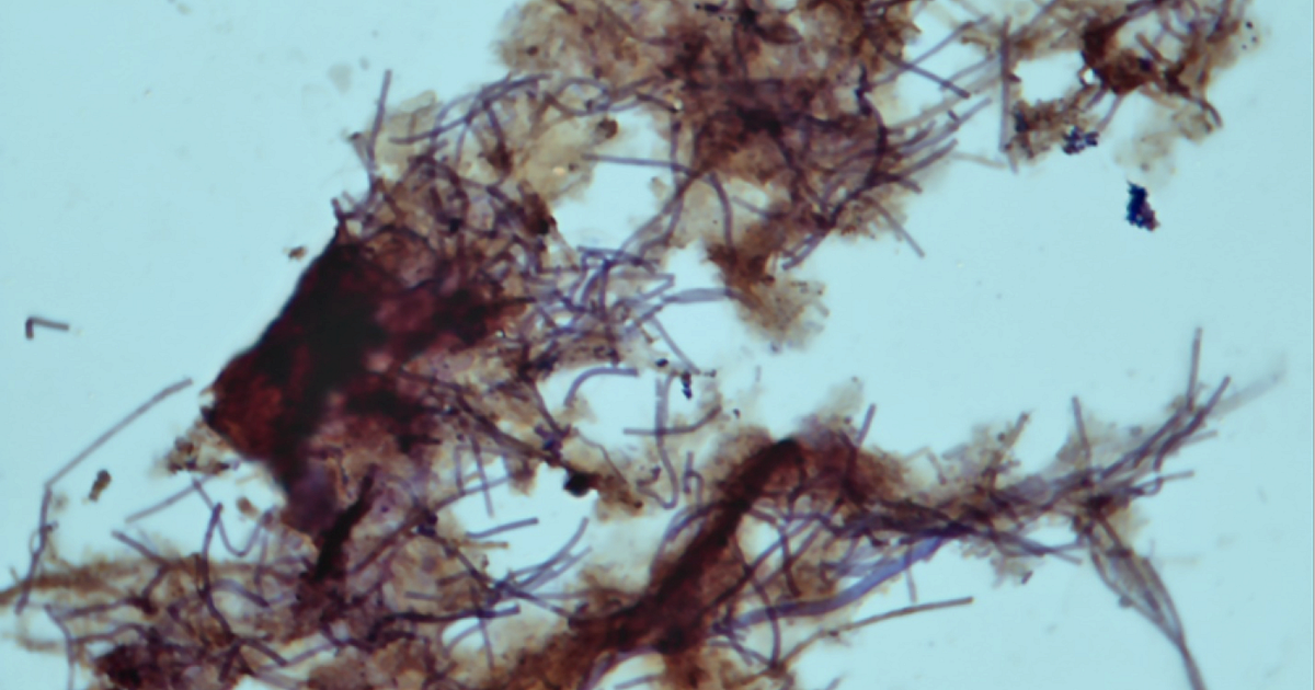 Bug of the Month: Filament Type 0092 and… | Treatment Plant Operator