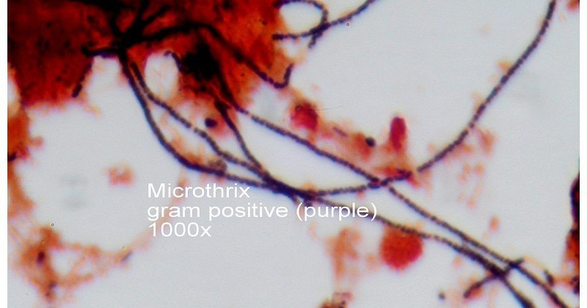 Microtrichae Insect Bug of the Month: Control Strategies for… | Treatment Plant Operator