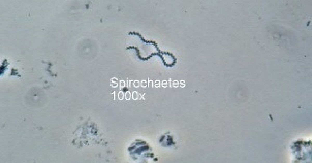 Spirochaetes in Wastewater: What… | Treatment Plant Operator