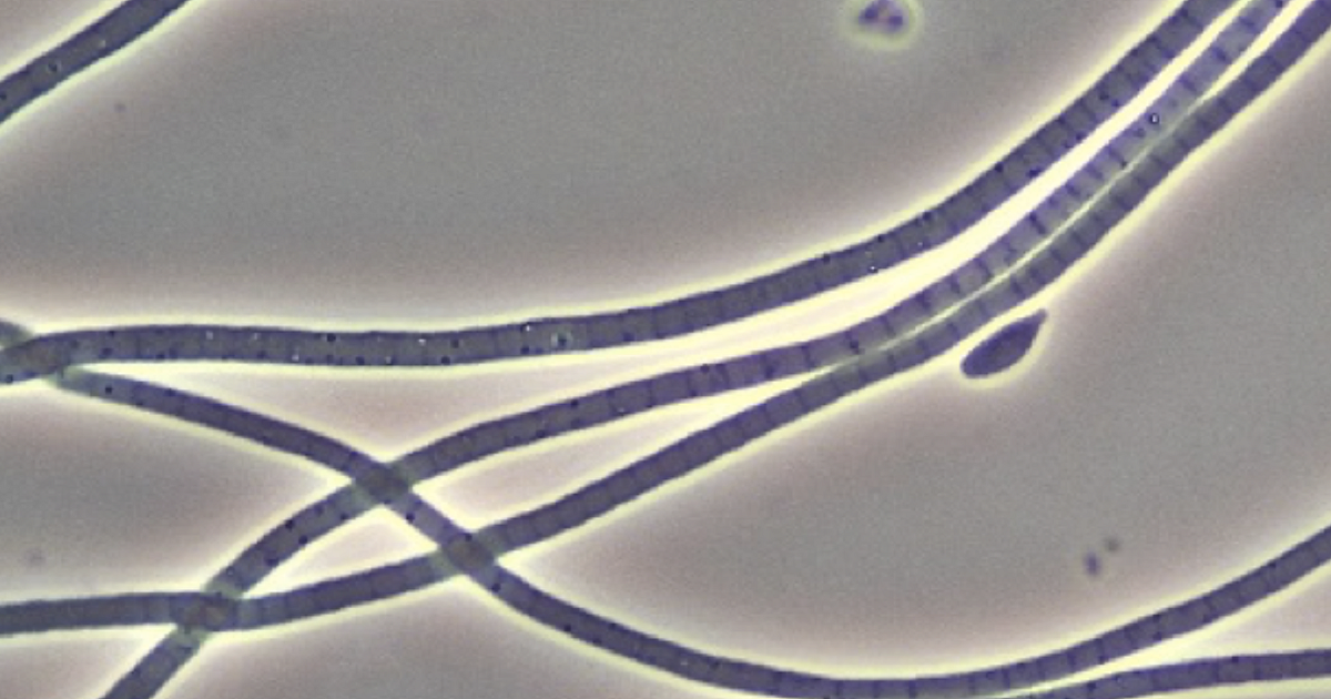 Bug of the Month: Sludge Bulking and… | Treatment Plant Operator