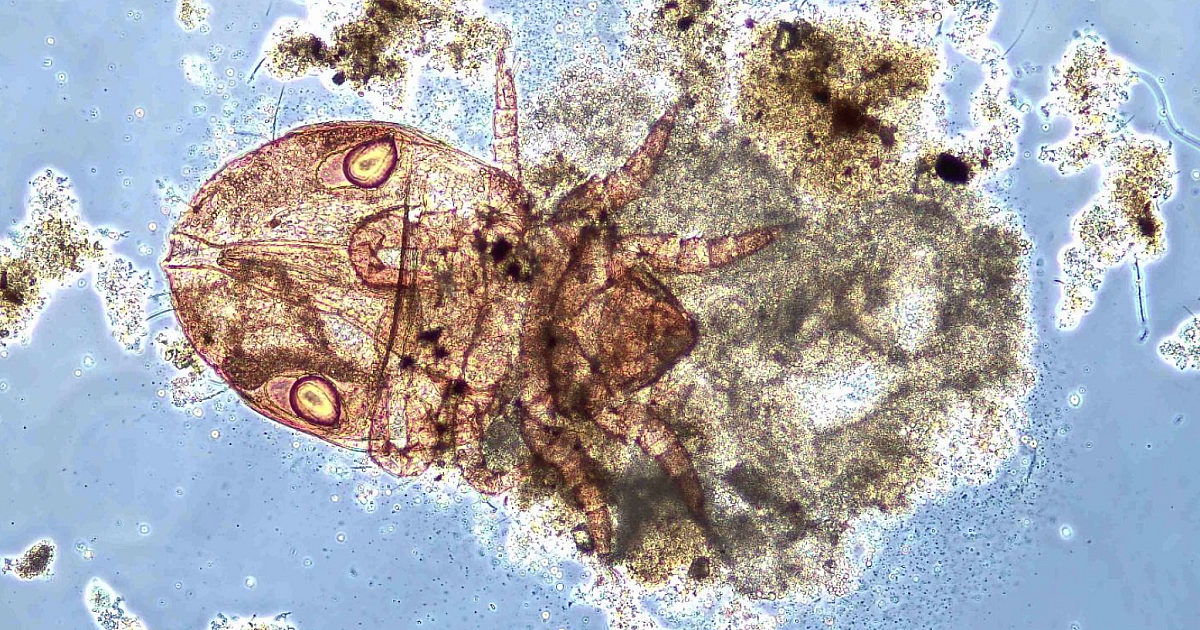 Bug of the Month: Water Mites Are Often a… | Treatment Plant Operator