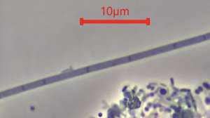 Bug Type 0961