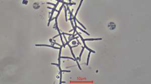 Bug Actinomycetes Mycolata