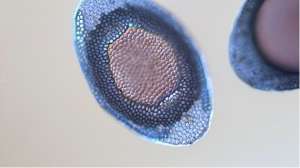 Water sponge microbiology