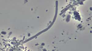Bug 0411