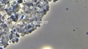 Bug nitrosomonas