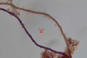 Bug Variable Staining