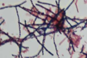 Bug Actinomycetes Mycolata 24 2 12