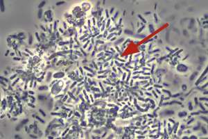 Bug irregular formations