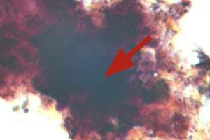 Bug ca accumulibacter