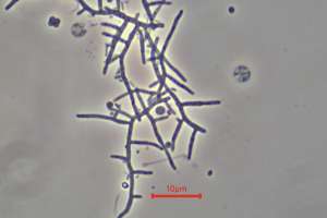 Bug Actinomycetes Mycolata