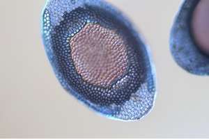 Water sponge microbiology