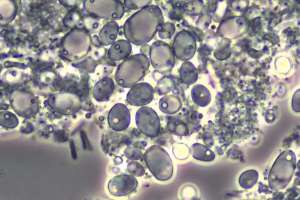Bug yeast