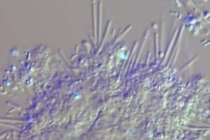 Bug haliscomenobacter