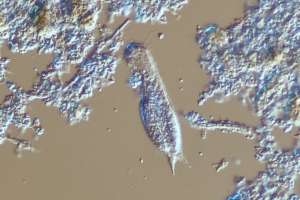 Bug of month gastrotrich