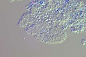 Nitrosomonas 1000x DIC cropped