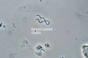Bug spirochaetes