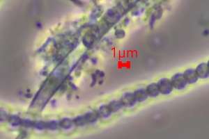 Dead Unhealthy Filaments