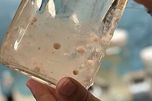 Microplastic Pollution